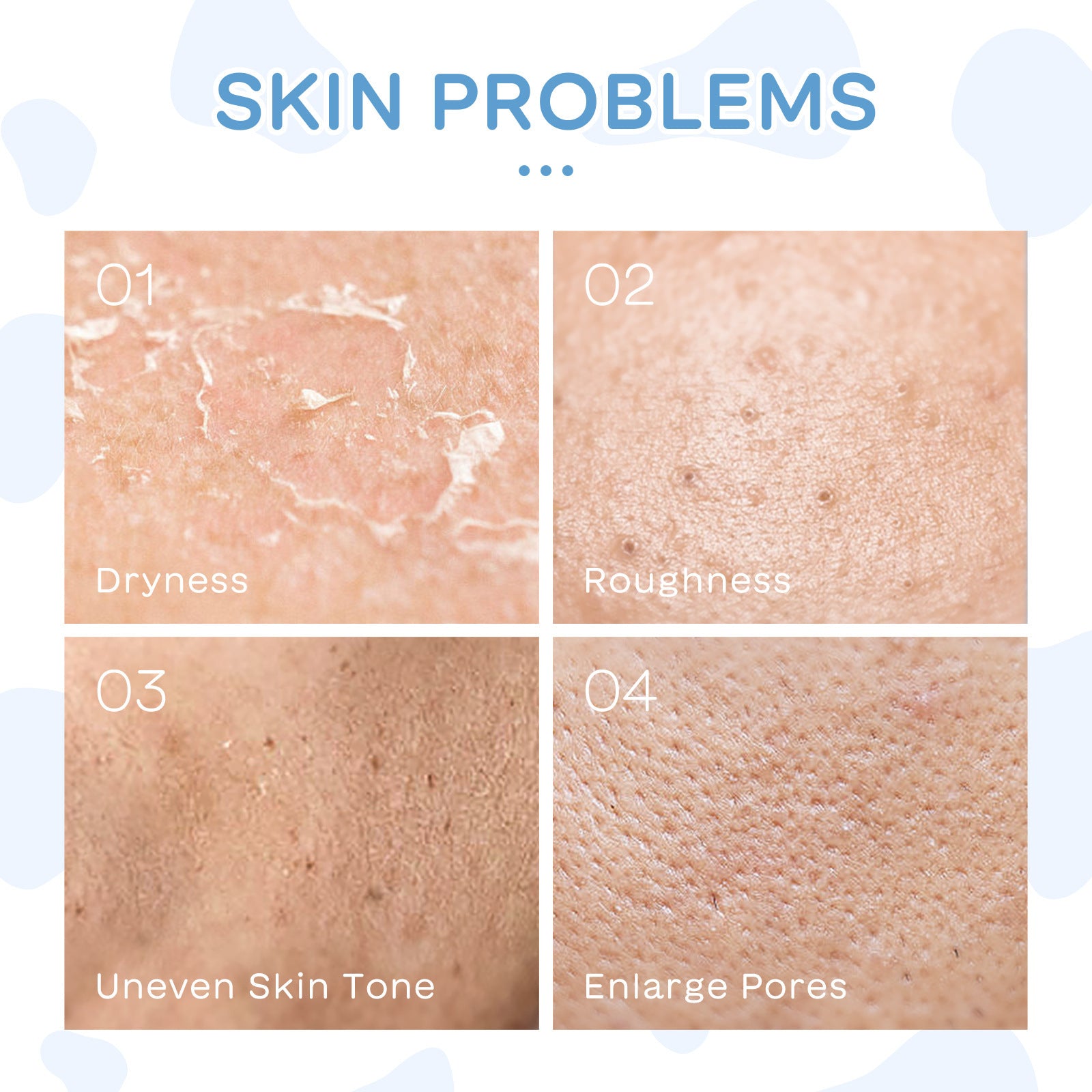 Ensemble de 5 produits de soin hydratant pour le visage au lait