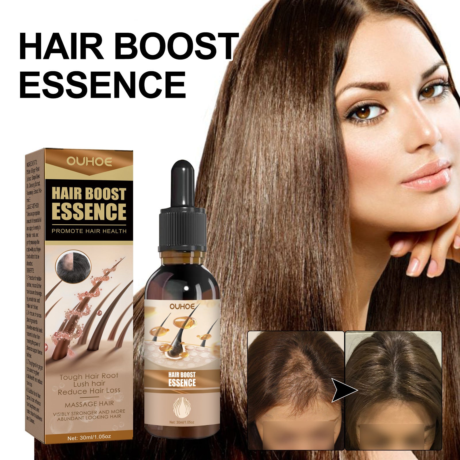 Essential Oil Improves Dry And Manic Hair Loss Prevention