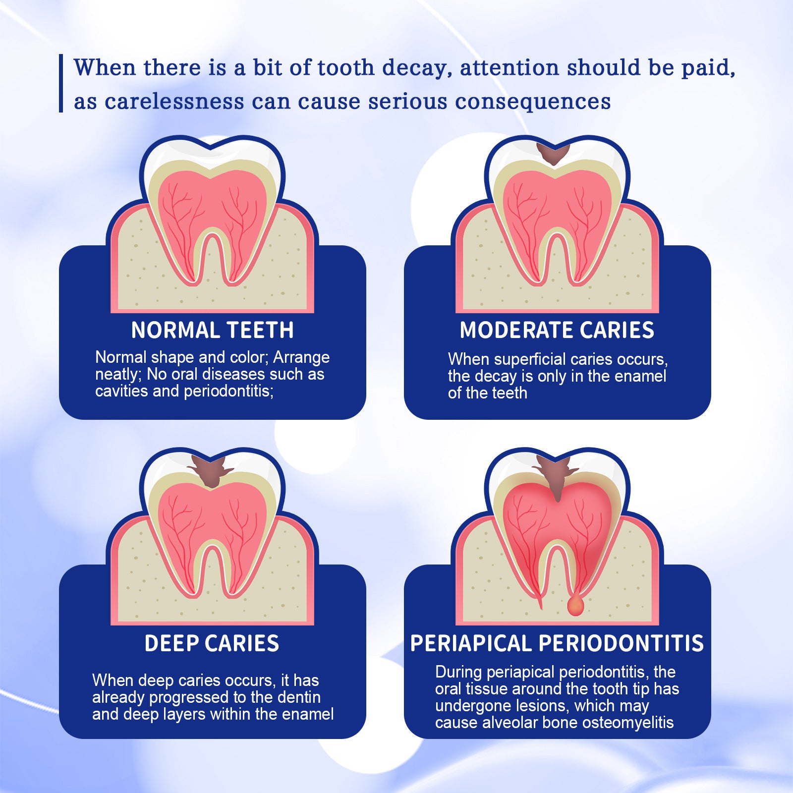 Dentifrice Anticaries Nettoyage Buccal Jaunissement Dentaire Carie Soin Dentaire Fixation Gencives Soin Dentaire Haleine