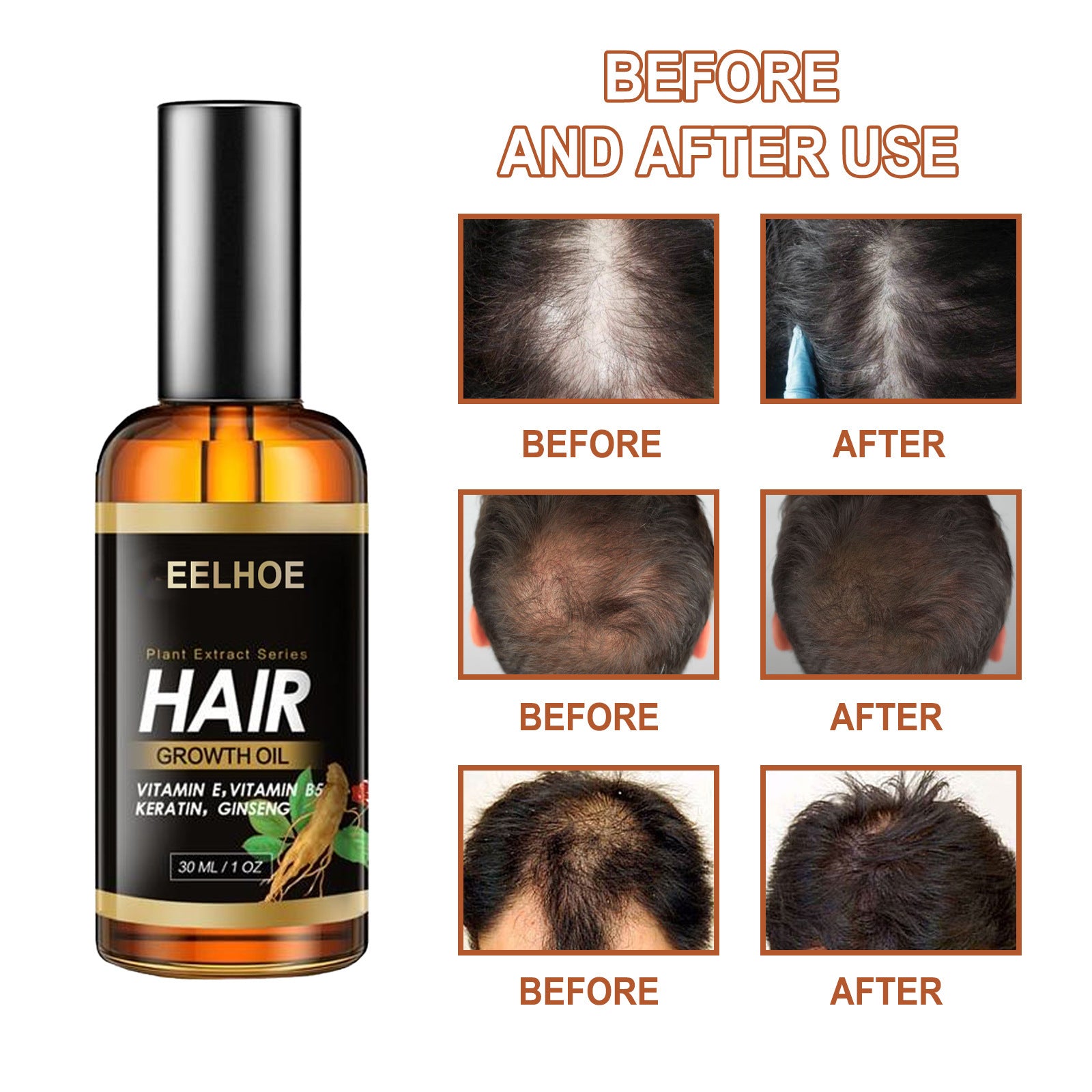 EELHOE Huile Essentielle Végétale pour Cheveux Coiffure Soin des Cheveux Huile Essentielle Cheveux Forts Réduire la Chute des Cheveux Cheveux Cassants Huile Essentielle Soin des Cheveux