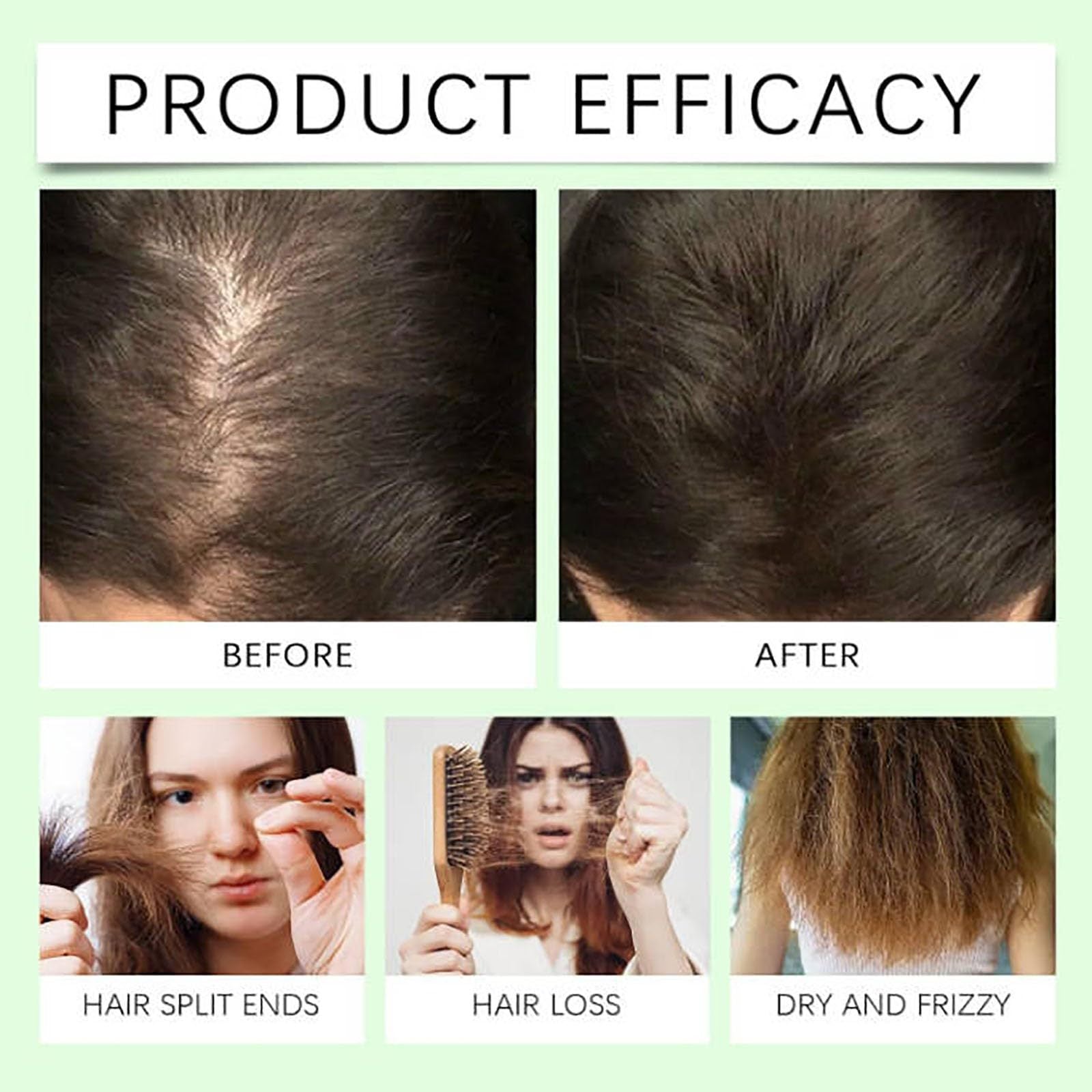 Anti-hair Loss Shampoo