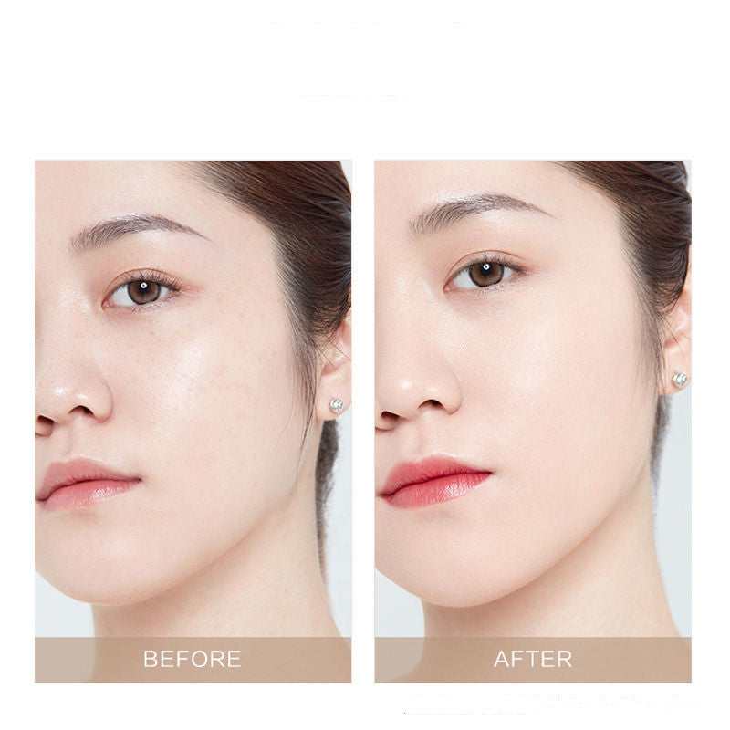 Concealer Dark Circles Acne Removal Creamy Concealer Facial Acne Removal