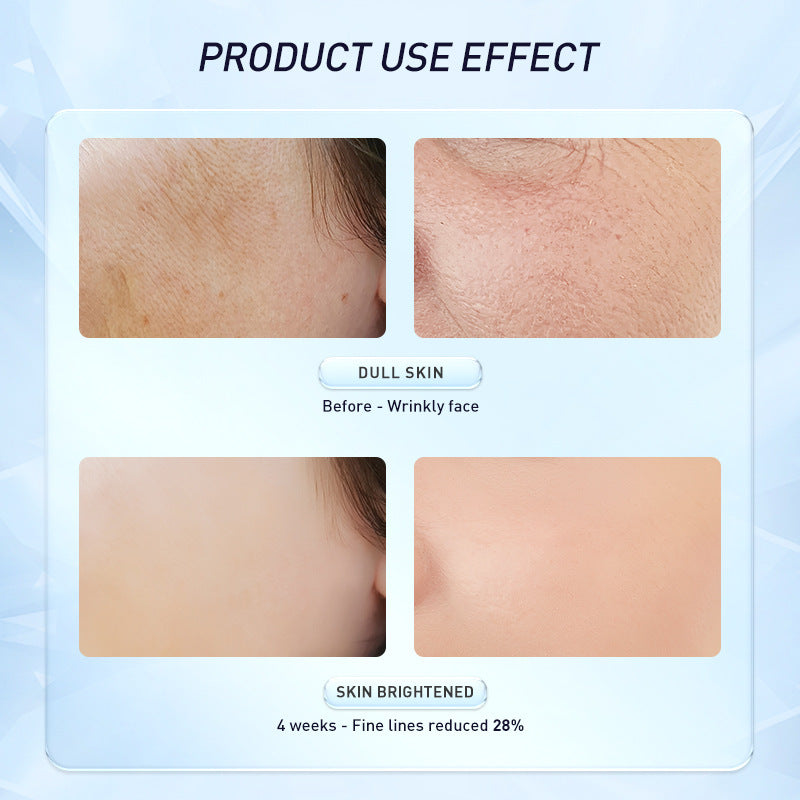Hydrating Moisturizing Improves Skin Tone A Alcohol Repair Cream