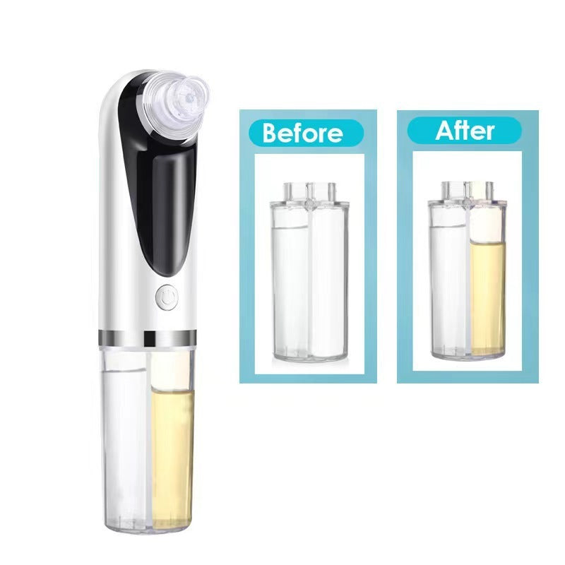 Appareil de beauté pour points noirs à petite bulle Instrument de nettoyage en profondeur du visage