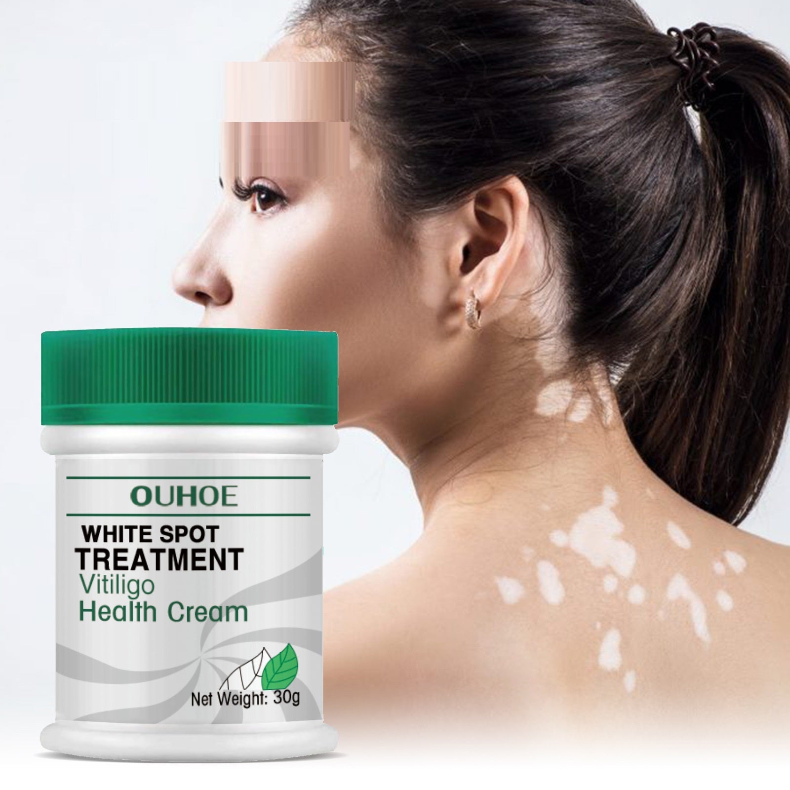 Repair Fade White Spots Melanin Hand And Foot Skin Moss Efficacy On Skin Neck Cream