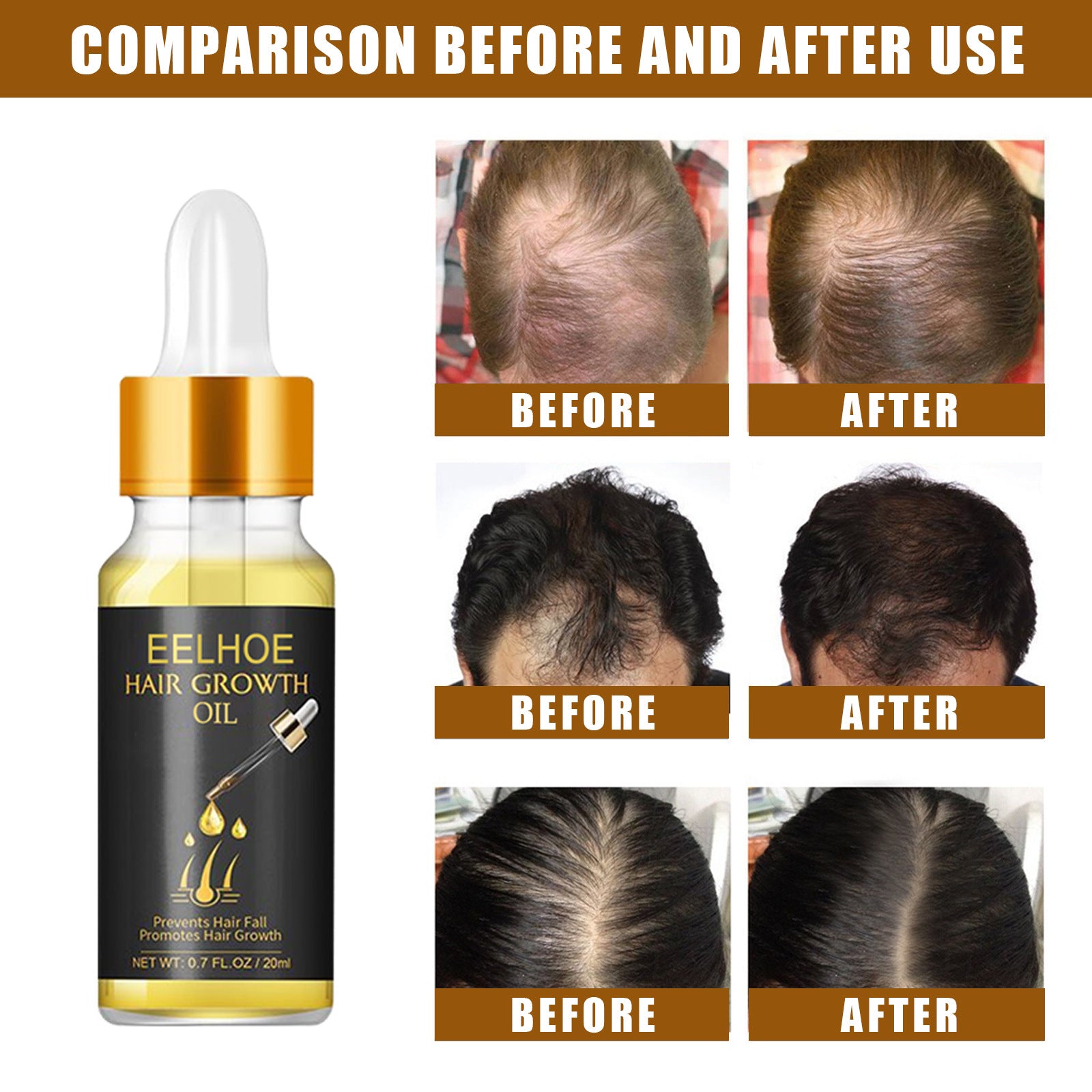Hair Growth Essential Oil Care Essential Nutrient Liquid