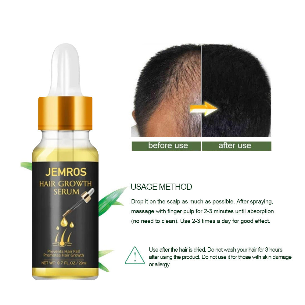 Huiles essentielles pour la croissance des cheveux Liquide de croissance capillaire Huiles essentielles de soin capillaire