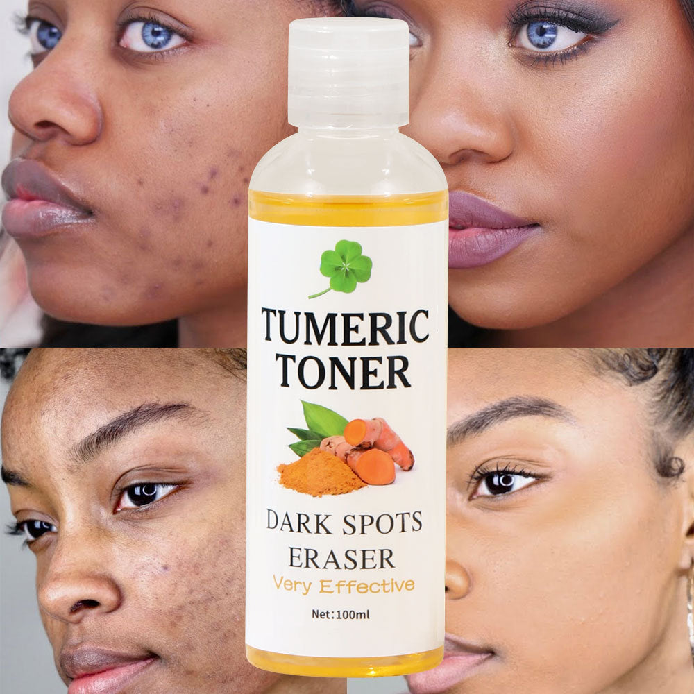 Lotion adoucissante pour la peau, tonique au curcuma noir anti-taches