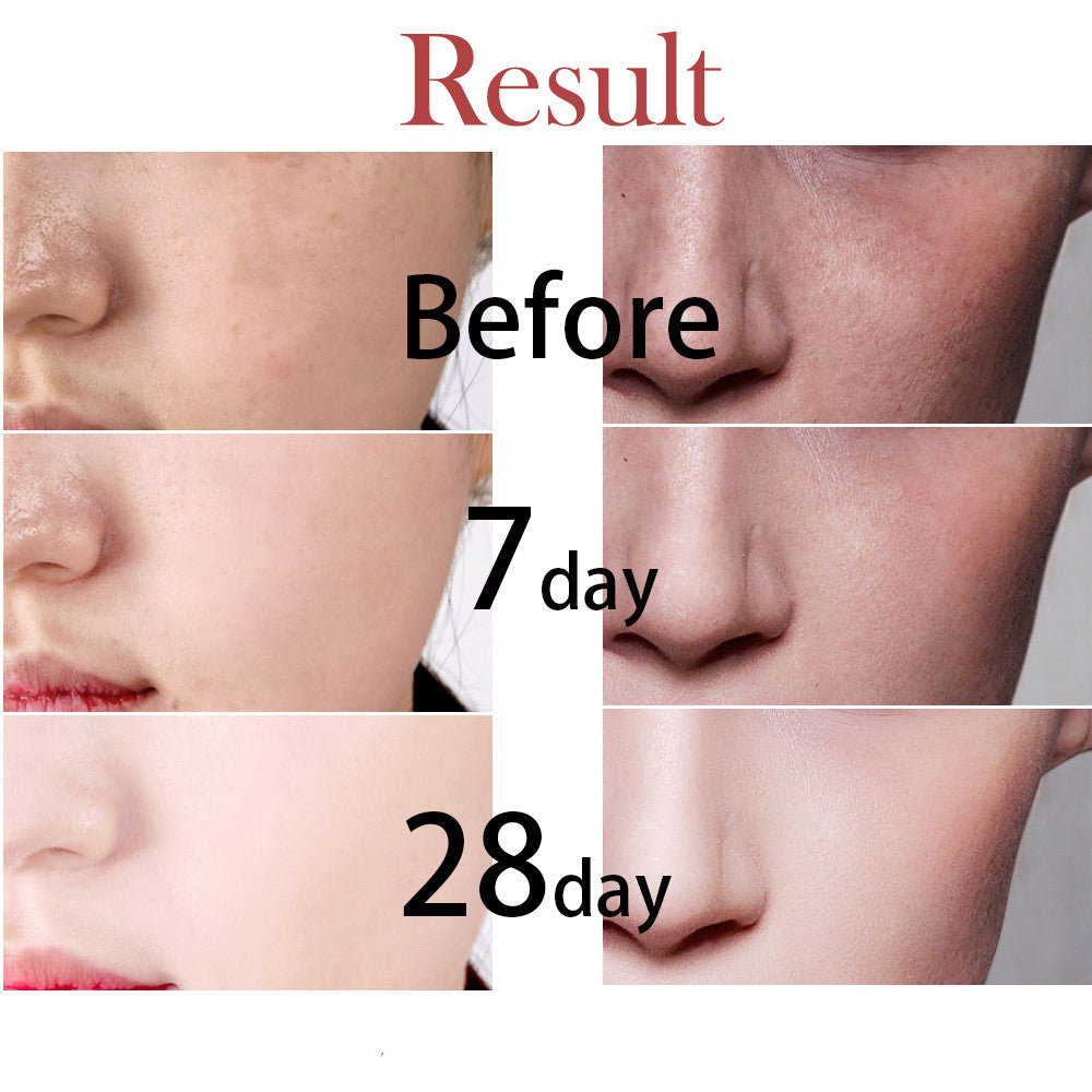 Sérum Visage Éclaircissant à l'Arbutine et Niacinamide