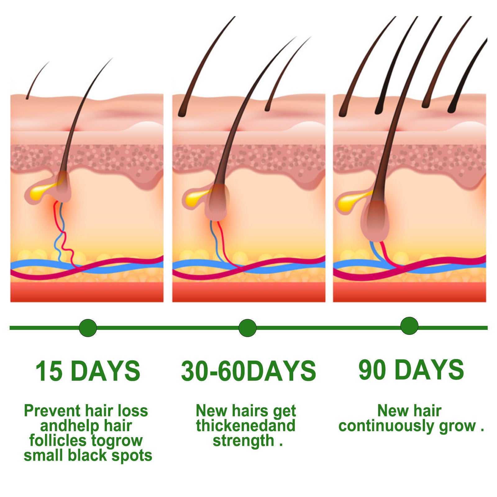 Huile essentielle de romarin pour les soins capillaires Anti-chute Croissance des cheveux Soin capillaire Nourrit le cuir chevelu et les racines des cheveux