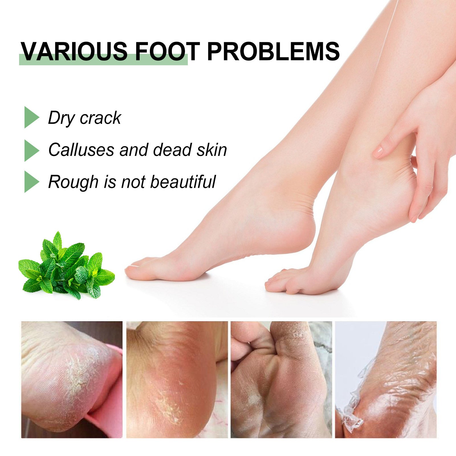 Crème anti-gerçures et anti-desquamation pour les pieds et le cou