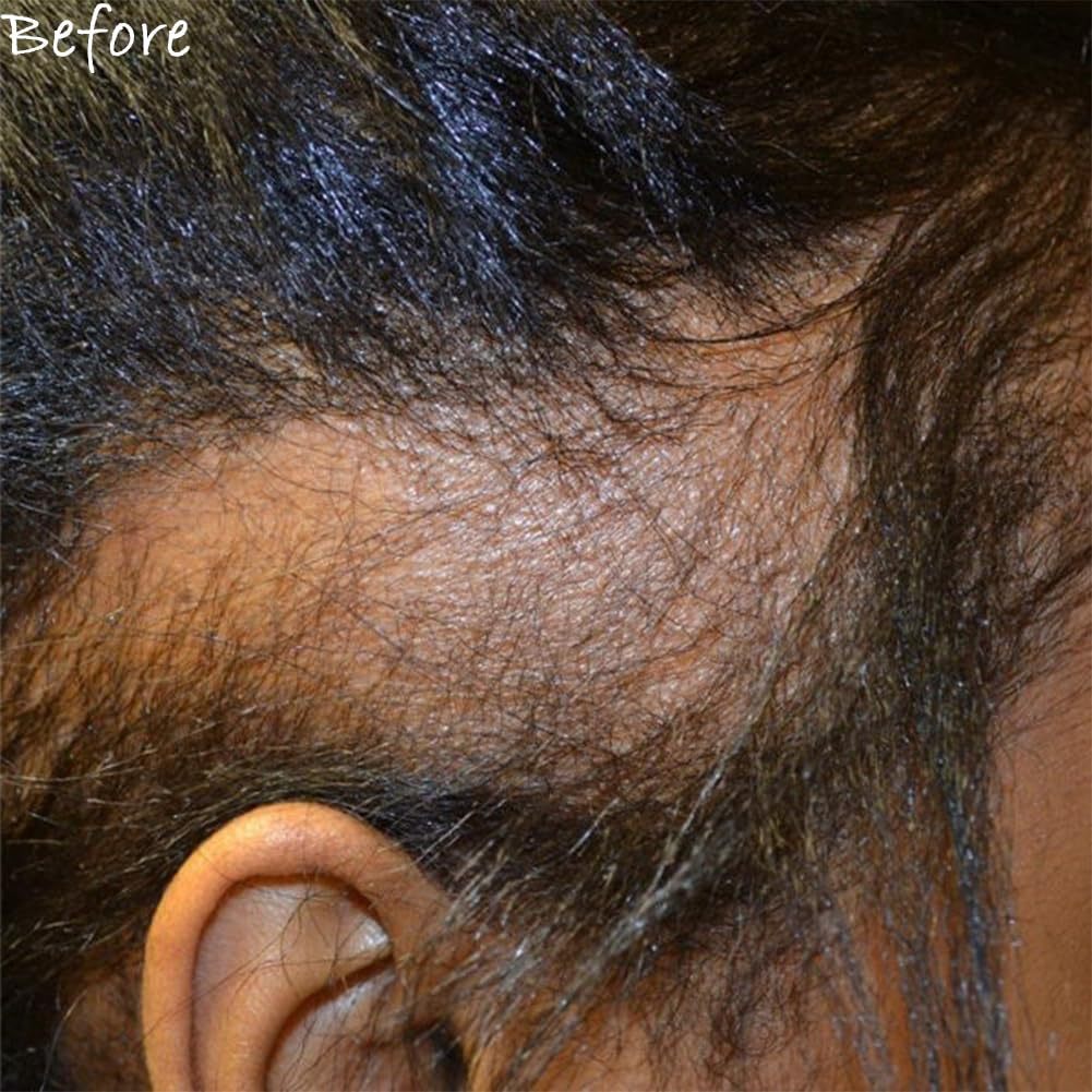 10 N 1Cherbe Oil For Hair Growth Liquid