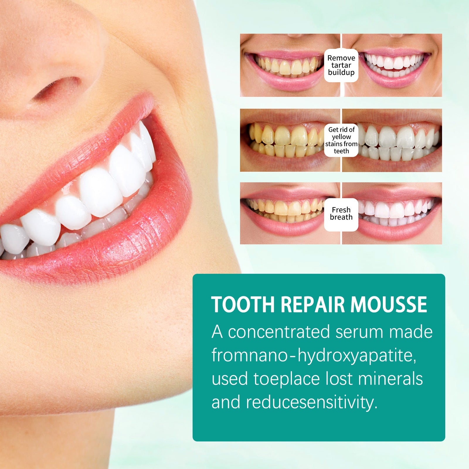 Whitening Toothpaste Moth-proof Cleaning Teeth Stains Gum Care