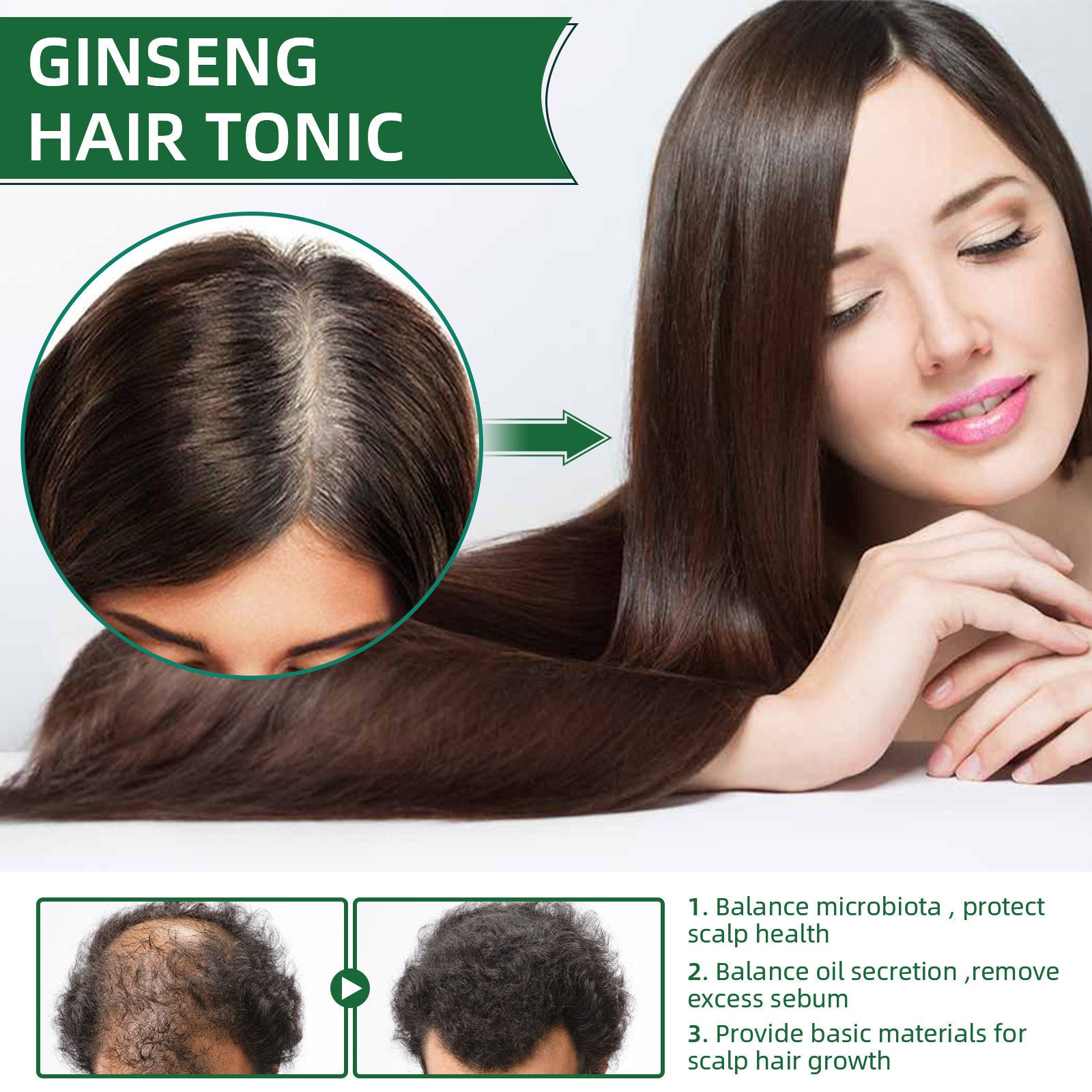 Vaporisateur liquide pour la croissance des cheveux au ginseng pour prévenir la perte de cheveux