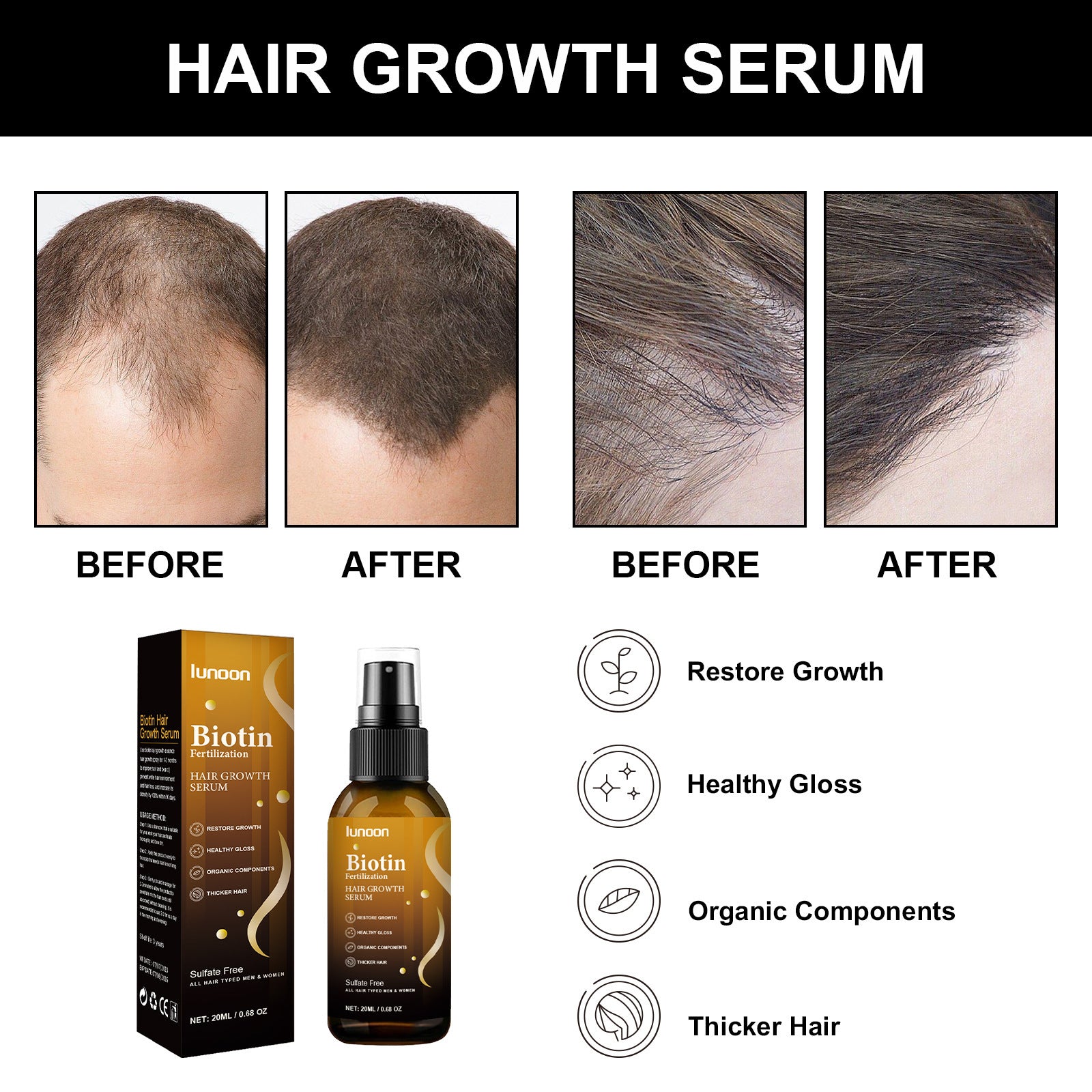 Biotin Hair Growth Spray Strong And Tough Anti-fall