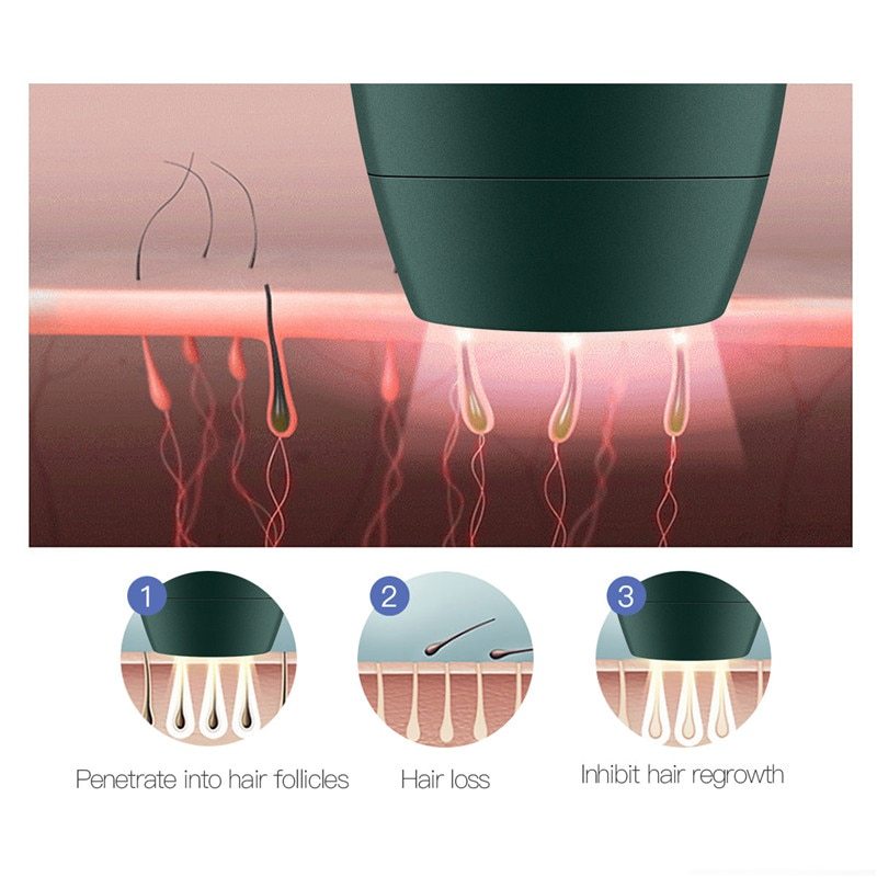 Épilateur laser domestique