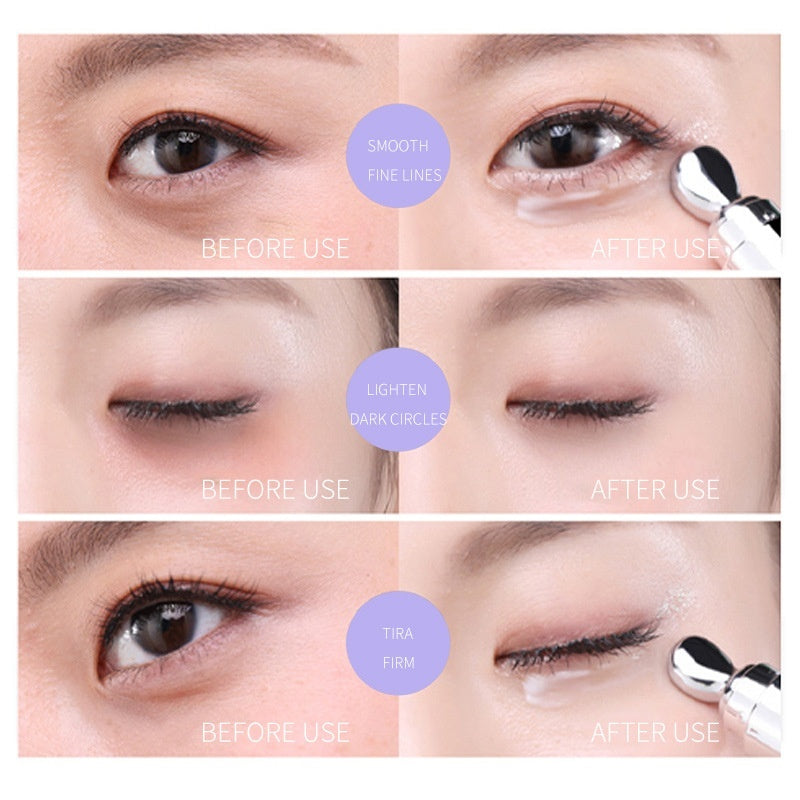 Hexapeptide Shock Lightening Eye Bags Eye Circumference Fine Lines And Dark Circles Eye Cream