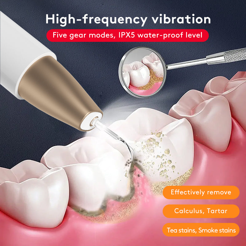 Teeth-Grinding Ultrasonic Tooth Cleaner, Stain & Tartar Remover, Teeth Whitening Device, Oral Care Instrument