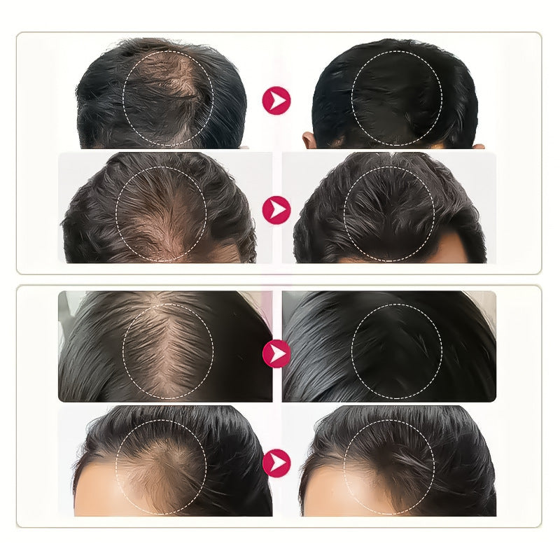 Nutrient Solution Collagen Hair Growth