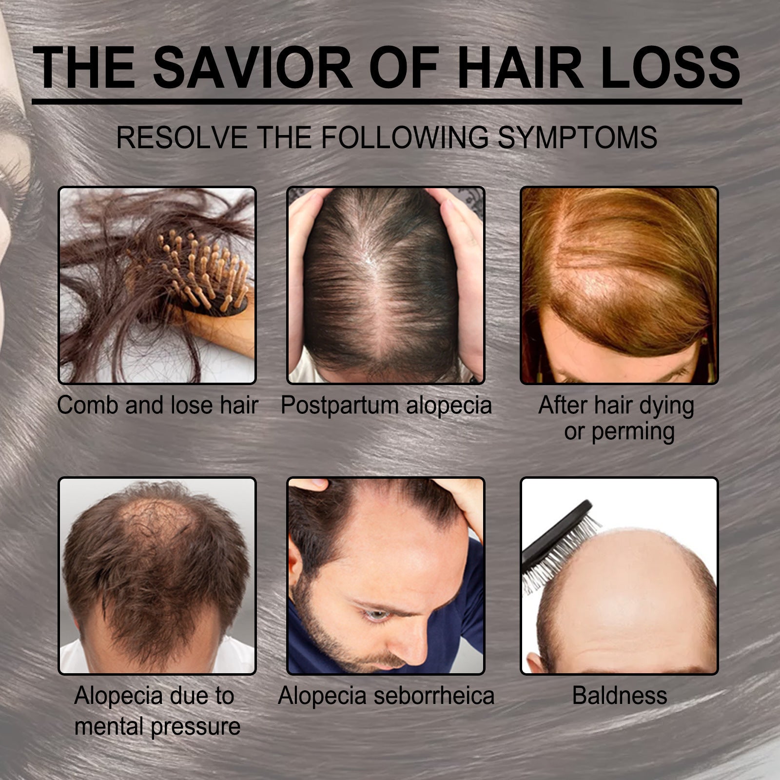 Huile essentielle de romarin pour les soins capillaires Anti-chute Croissance des cheveux Soin capillaire Nourrit le cuir chevelu et les racines des cheveux