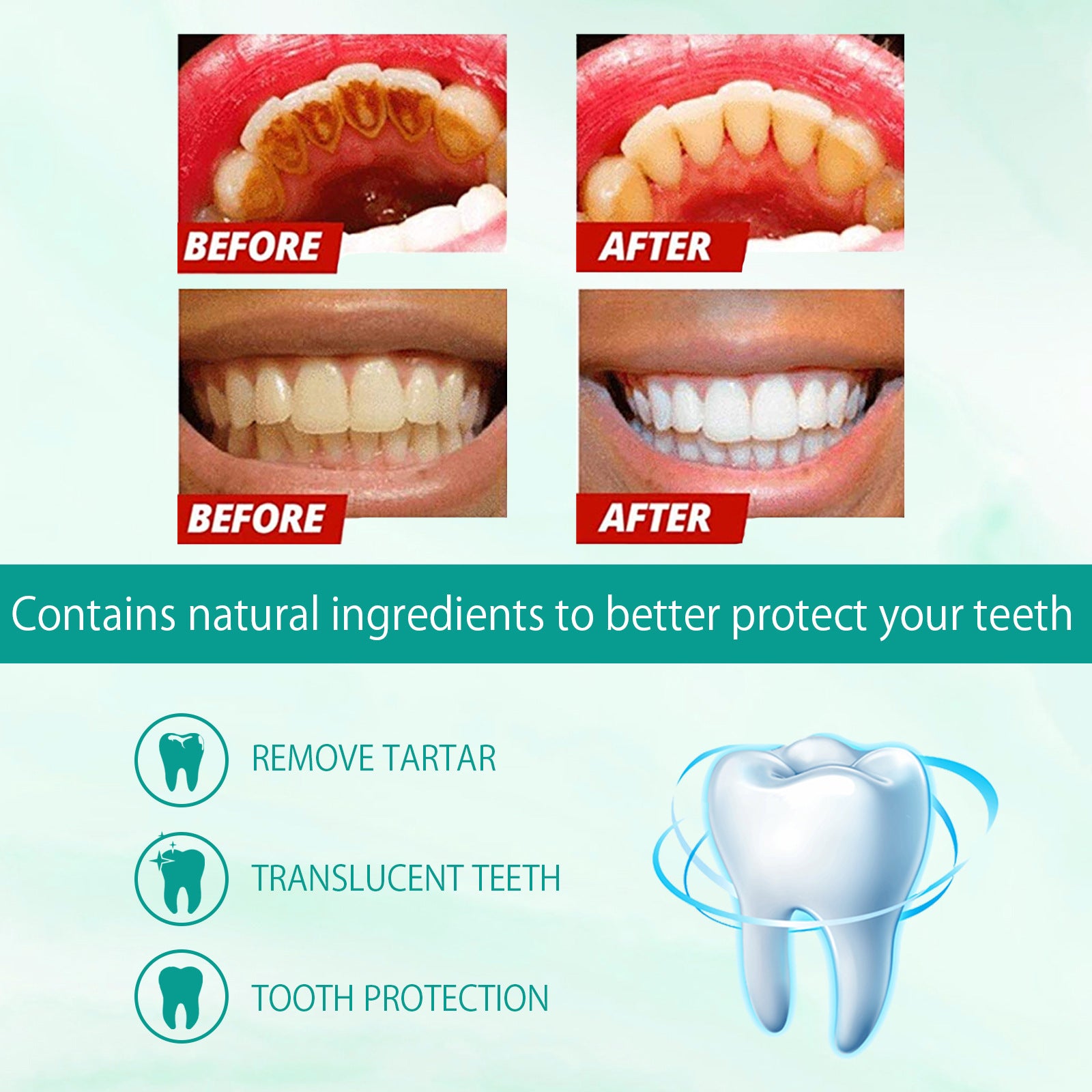 Whitening Toothpaste Moth-proof Cleaning Teeth Stains Gum Care