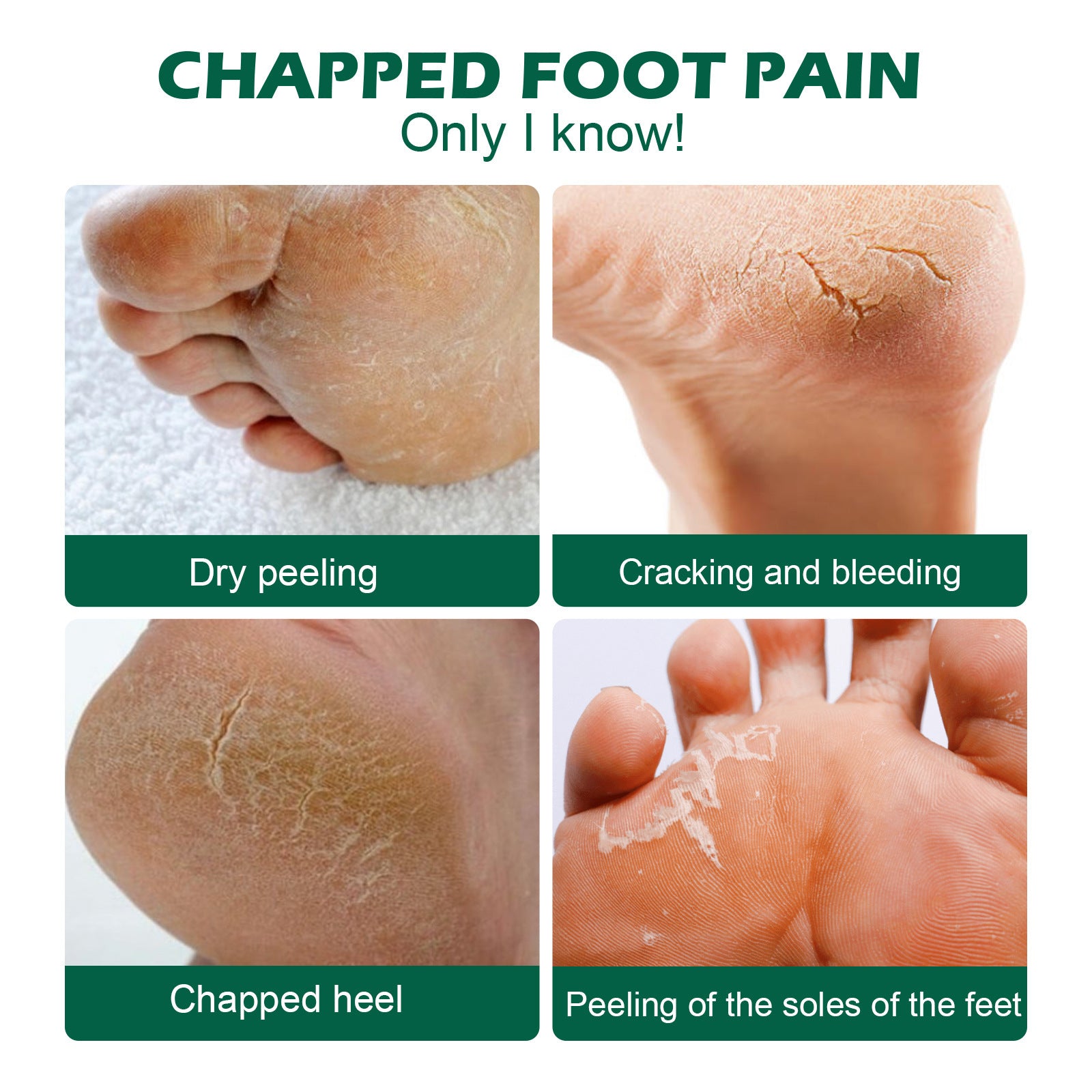 Repair Cracked Dryness And Itching Peeling Foot Neck Cream