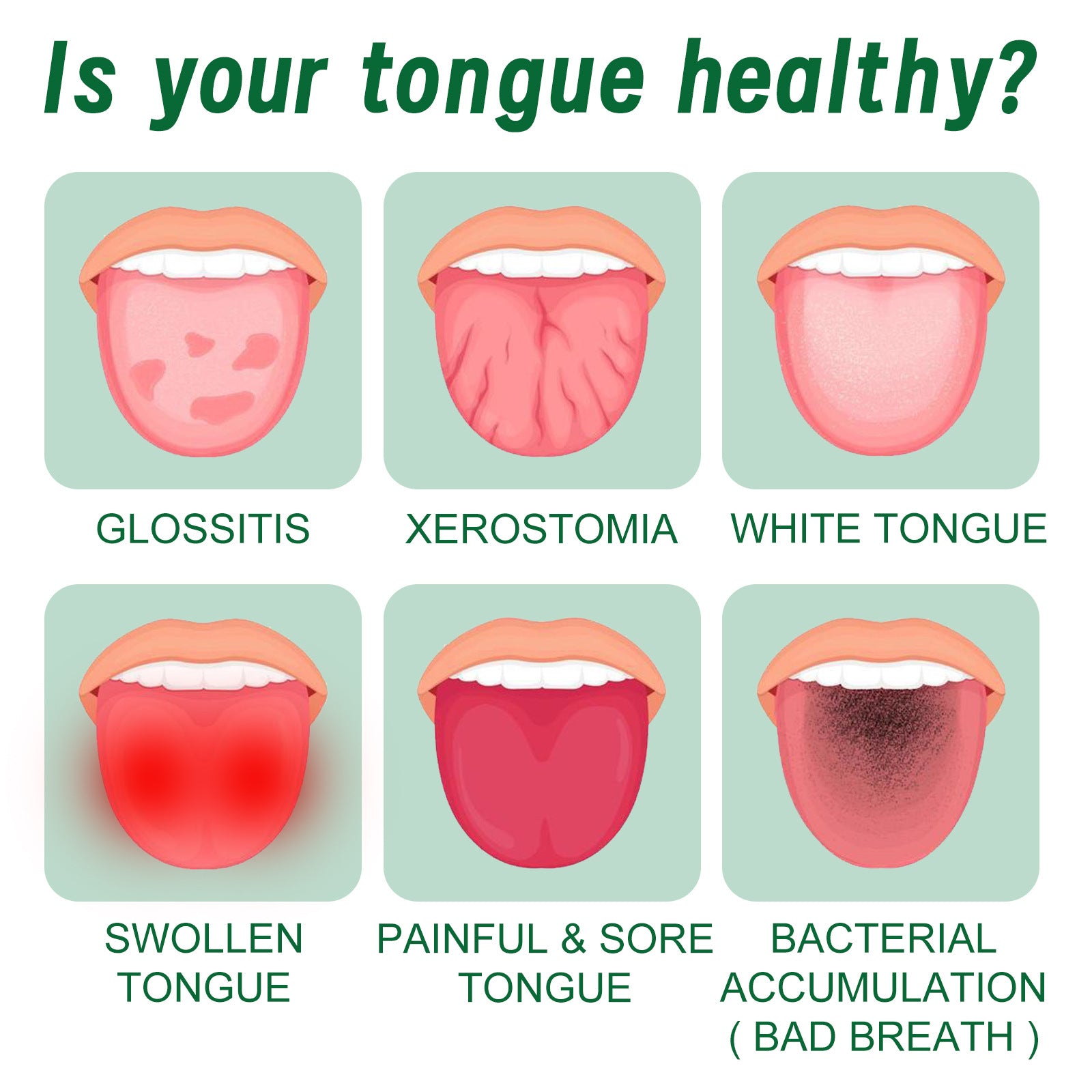 Curing Tongue Coating Whitening Relieving Tongue Cracking Swelling Oral Care Spray