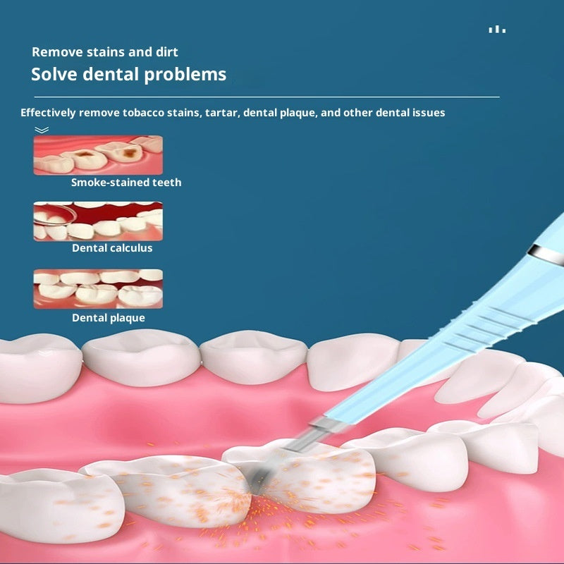 Sonic Electric Teeth Cleaning Machine Remove Tea Stains From Oral Tooth Stones
