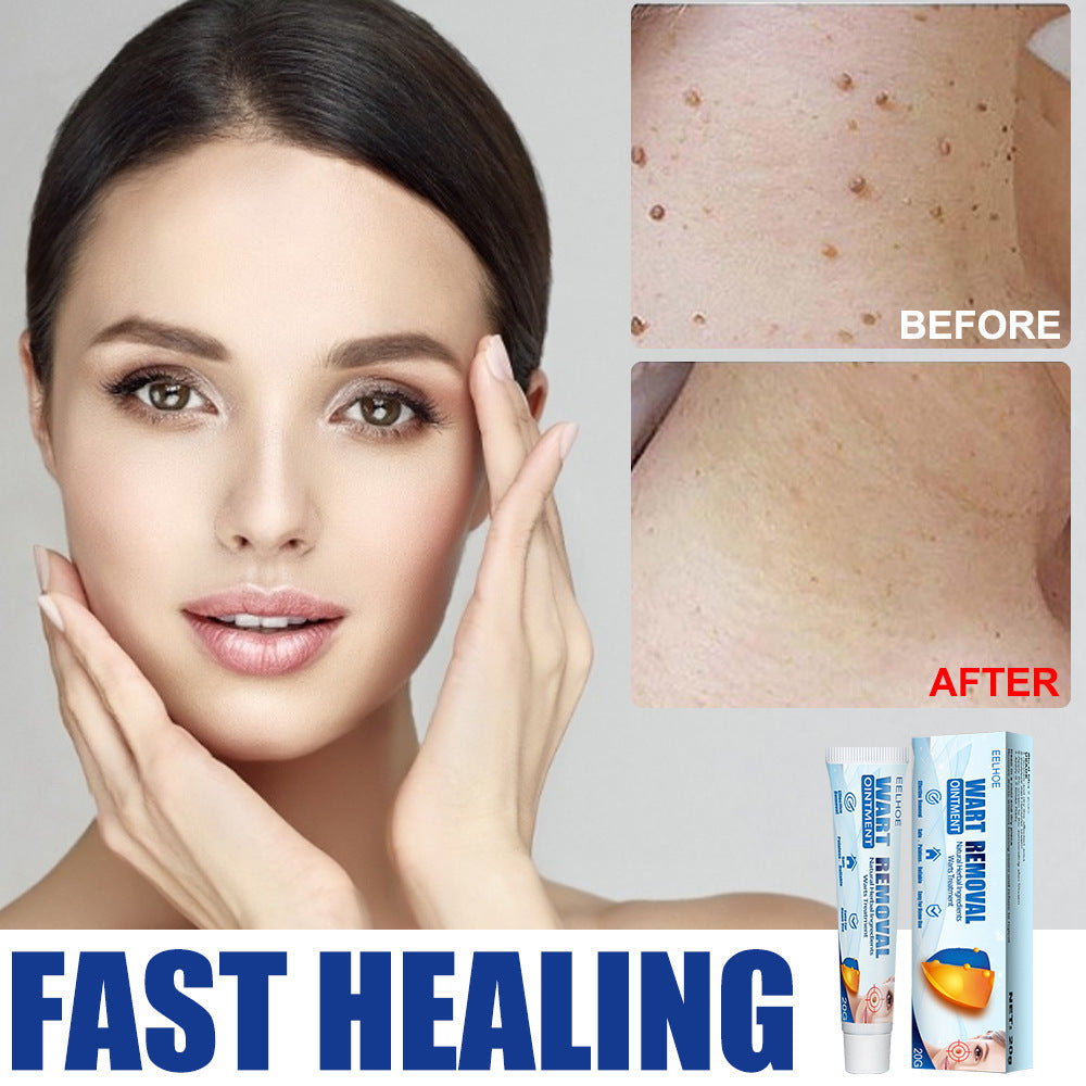 Hand And Foot Facial Armpit Flat Monkey Youke Wart Cream