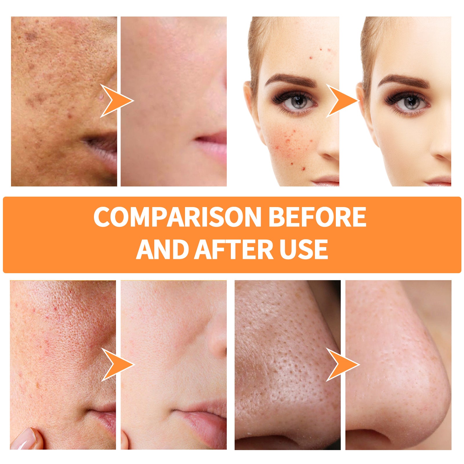Ginger Yellow Mud Facial Mask Solid Facial Mask Acne Removing Closed Mouth Shrink Pores