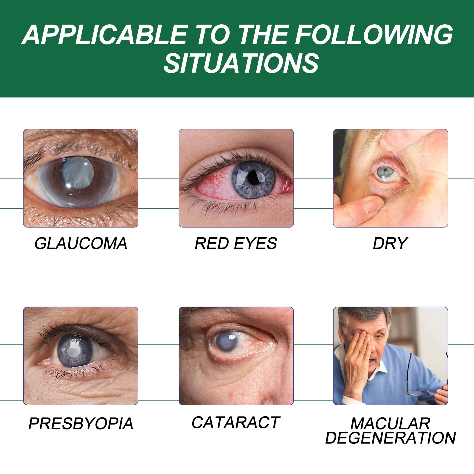 Relieving Eye Fatigue And Dry Care Solution