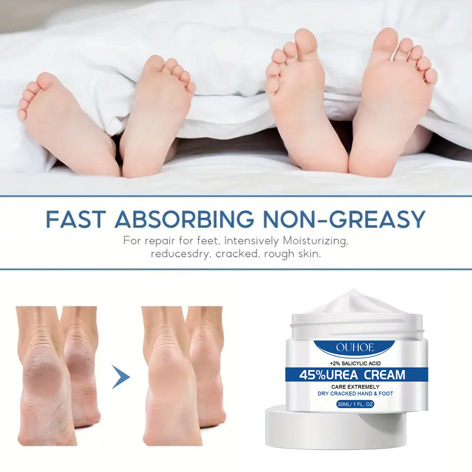 Hand And Foot Neck Cream Moisturizing Exfoliating Anti-heel