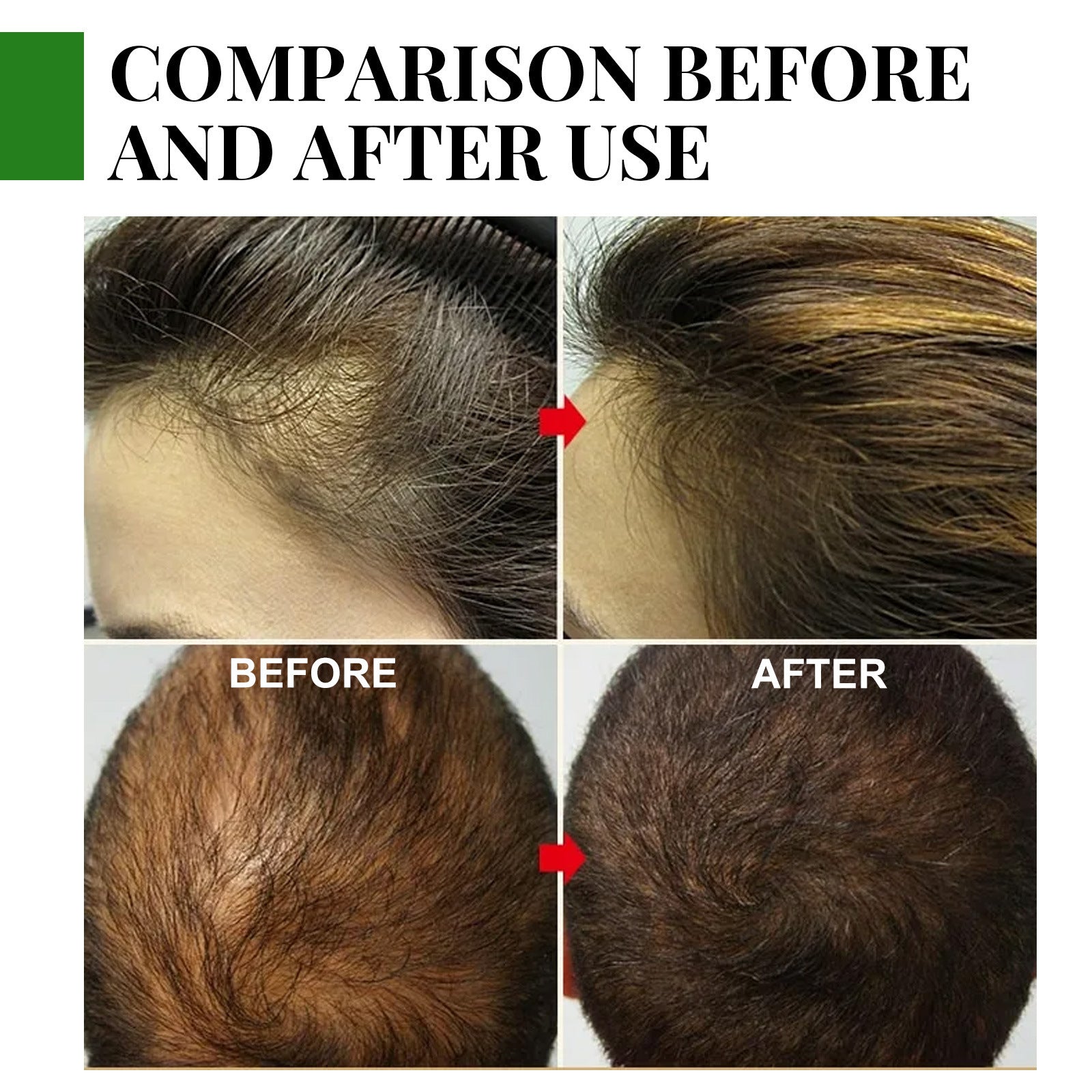 Huile essentielle de romarin pour les soins capillaires Anti-chute Croissance des cheveux Soin capillaire Nourrit le cuir chevelu et les racines des cheveux