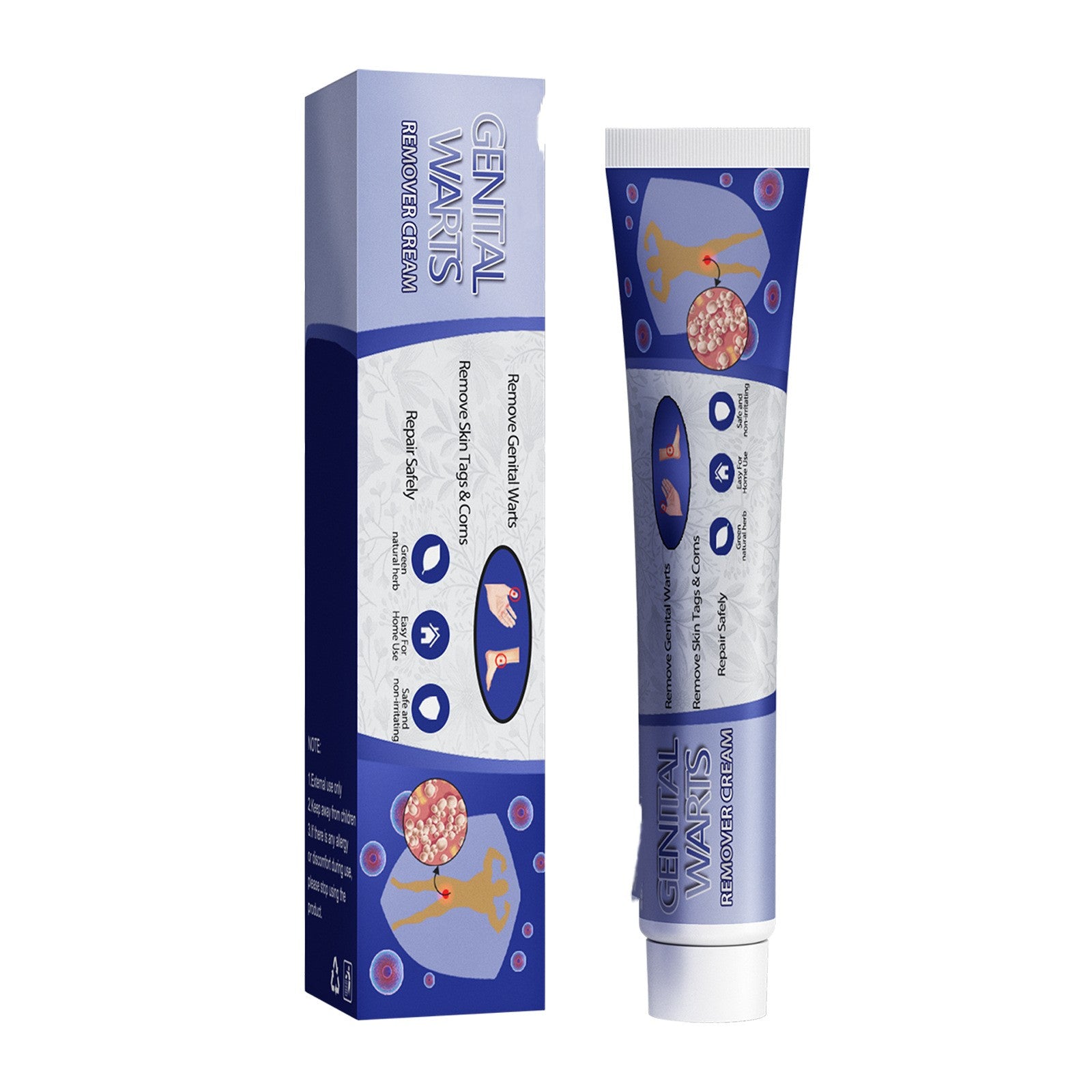 Ping Hou You Qu Wart Cream Hand Foot Facial Underarm Meat Granules