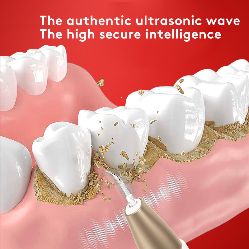 Teeth-Grinding Ultrasonic Tooth Cleaner, Stain & Tartar Remover, Teeth Whitening Device, Oral Care Instrument