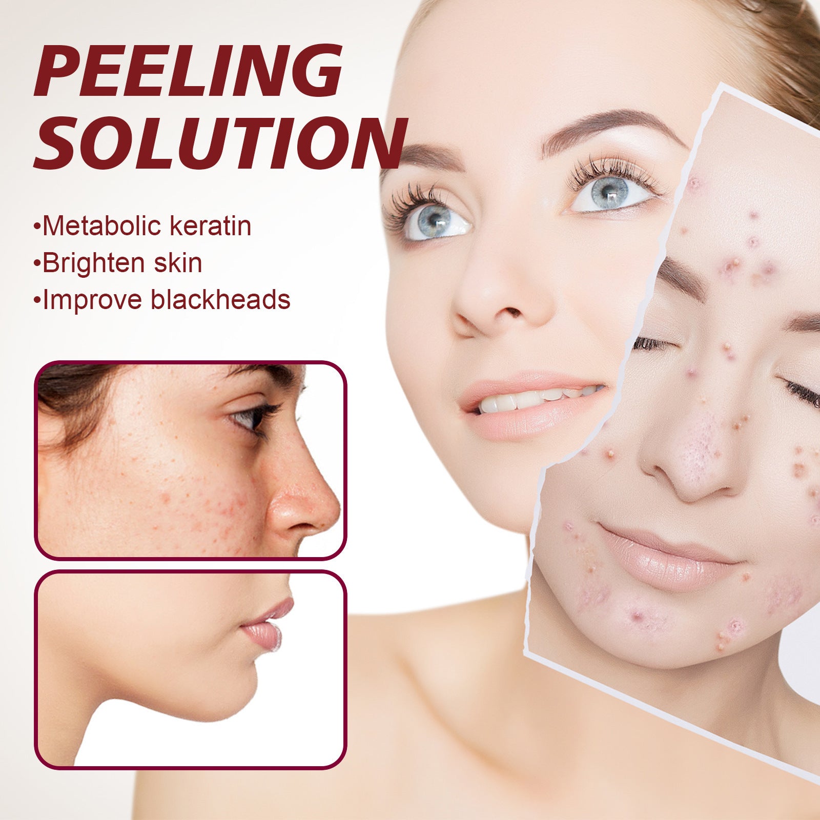 Tender Pores Moisturizing And Softening Cutin Skin Fading Spots Moisturizing Toner